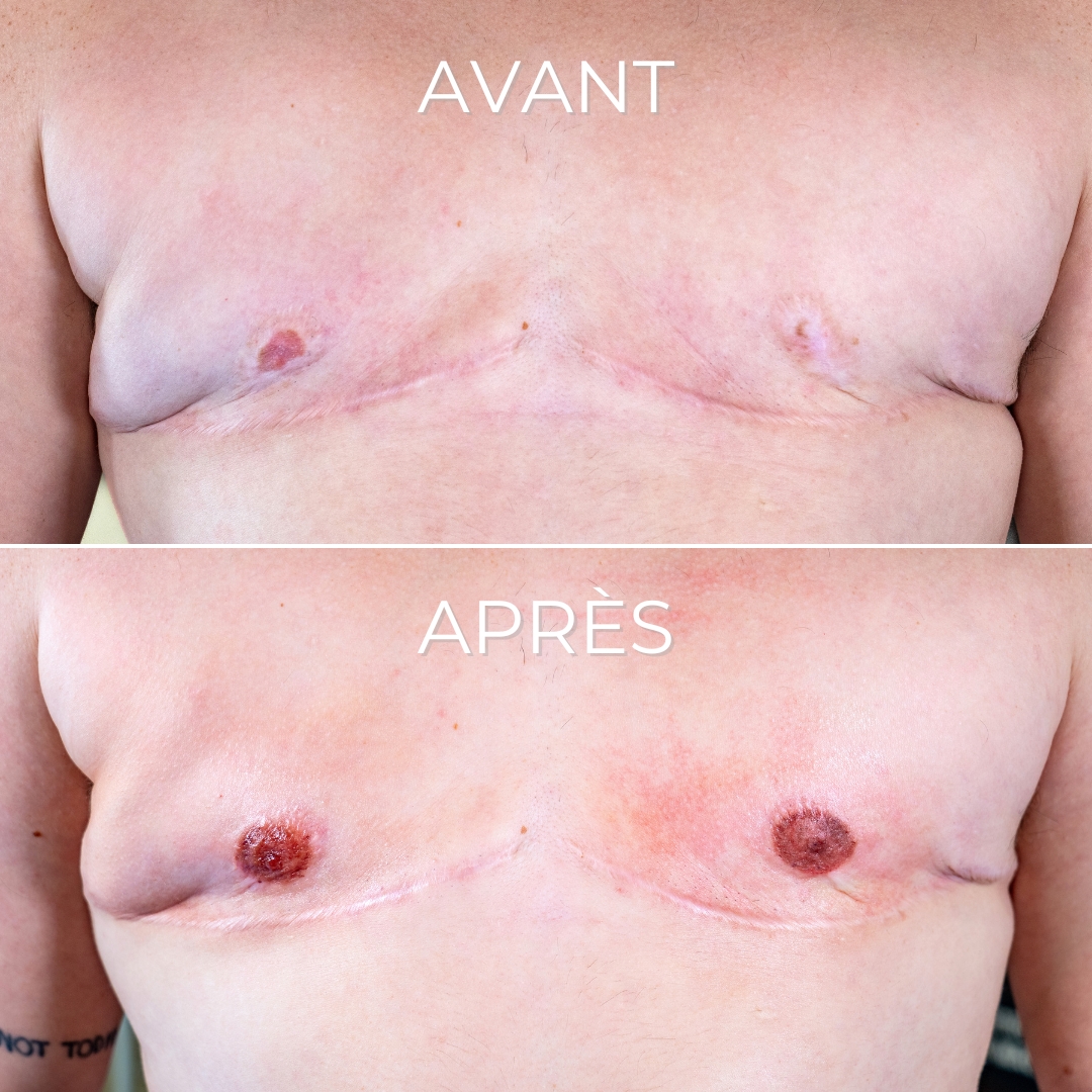 Design sans titre - 1