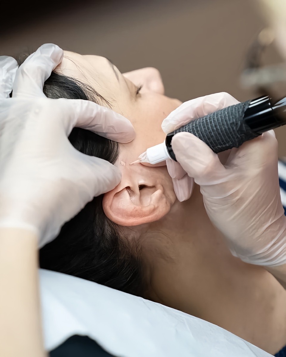 thumbnail_super_resolution_20250414085230299